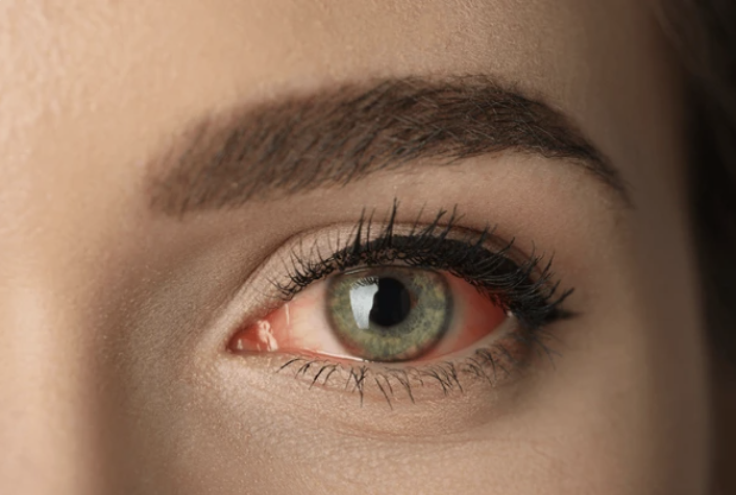 Treatment of eye infections and inflammations